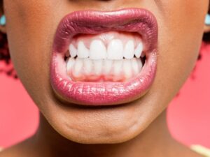 Lee más sobre el artículo 🦷 Nombre y función de tus piezas dentales