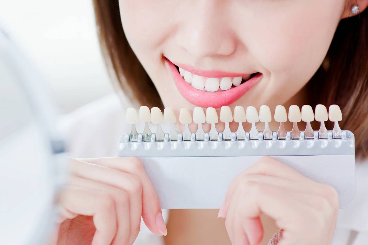 Lee más sobre el artículo 🦷 Clínica de estética dental en Santander