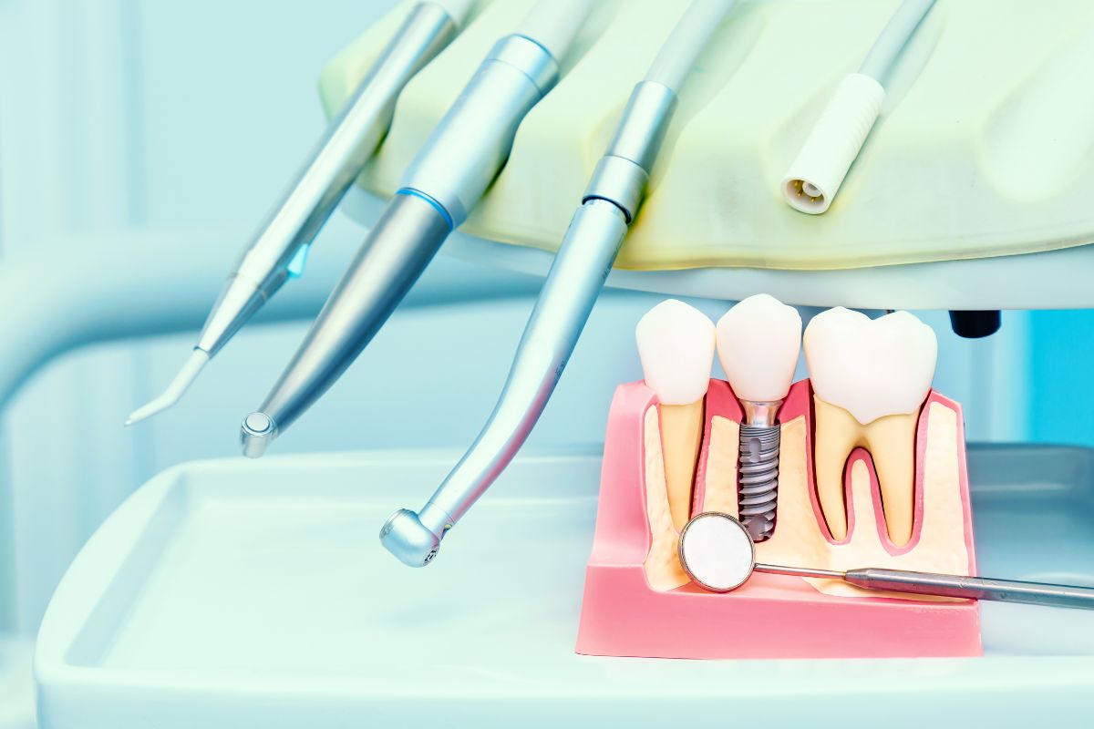 Tratamiento Implantología Dental en Santander - Clínica Dental Teresa Ortega