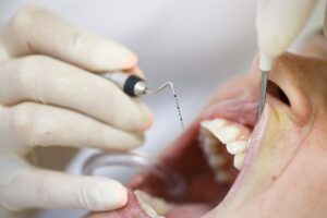 Lee más sobre el artículo 🦷 Tratamientos de periodoncia en Santander