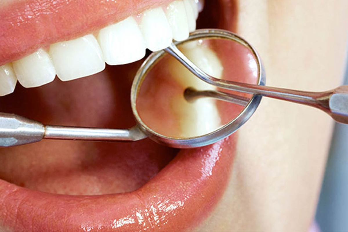 Lee más sobre el artículo 🦷 Beneficios de la odontología restauradora